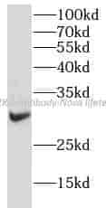 IL2RA Antibody - Click Image to Close