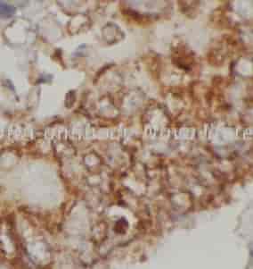IL4RA antibody - Click Image to Close
