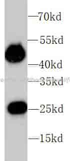 IgG control antibody - Click Image to Close