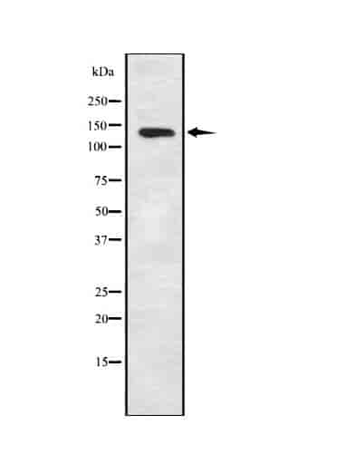 KCNT1 Antibody - Click Image to Close