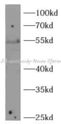 KLF4 antibody - Click Image to Close