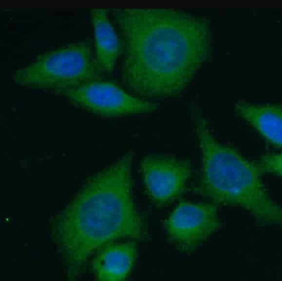 Polyclonal antibody-Leptin antibody - Click Image to Close