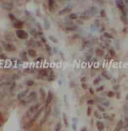 MED1 antibody - Click Image to Close