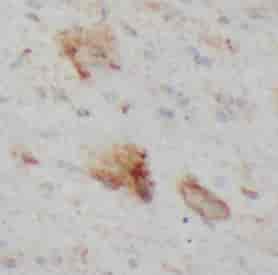MED4 antibody - Click Image to Close