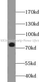 MEKK3 antibody - Click Image to Close