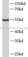 METTL4 antibody - Click Image to Close