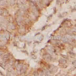 MGMT antibody - Click Image to Close