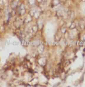 MSN antibody - Click Image to Close