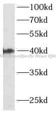 MTNR1B antibody - Click Image to Close