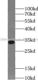 MYD88 antibody - Click Image to Close