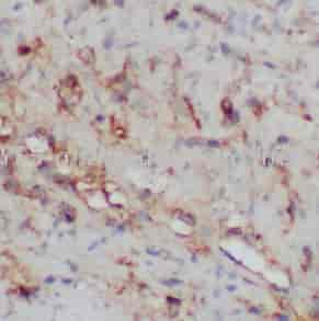 MYF5 antibody - Click Image to Close