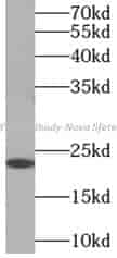 MYL3 antibody - Click Image to Close