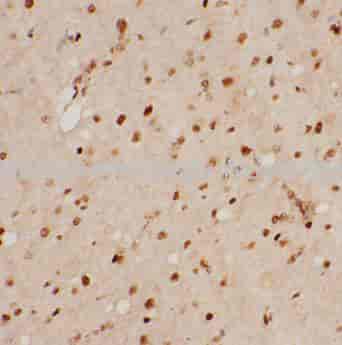 Melatonin antibody - Click Image to Close