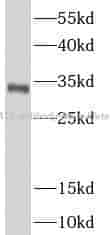 NAT1 antibody - Click Image to Close