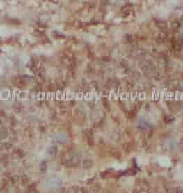 NCOR1 antibody - Click Image to Close
