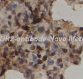 NCOR2 antibody - Click Image to Close