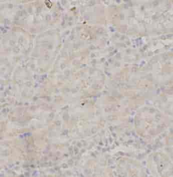 NOS3 antibody - Click Image to Close