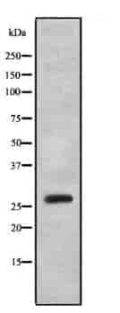 OTUB2 Antibody - Click Image to Close