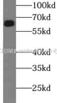 P62/SQSTM1 antibody - Click Image to Close