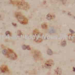 PACA antibody - Click Image to Close