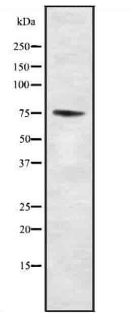 PAK6 Antibody - Click Image to Close