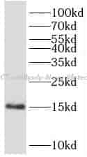 PCT antibody - Click Image to Close