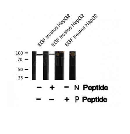 PDE4D (Phospho- Ser578) Antibody - Click Image to Close