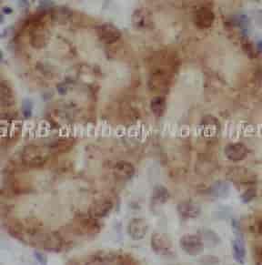 PDGFRB antibody