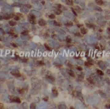 PELP1 antibody - Click Image to Close