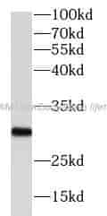 PGAM1 antibody - Click Image to Close