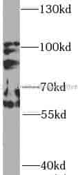PIK3R1 antibody - Click Image to Close