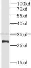 PINK1 antibody - Click Image to Close
