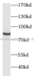 PKC gamma antibody - Click Image to Close