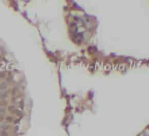 PLA2G4B antibody - Click Image to Close