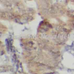 PLD2 antibody - Click Image to Close