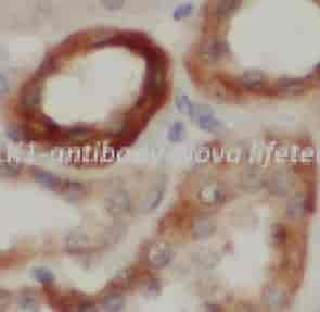 PLK1 antibody - Click Image to Close