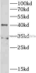 PPID antibody - Click Image to Close