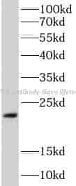 PPLA antibody - Click Image to Close