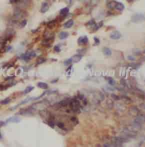 PRKCQ antibody - Click Image to Close