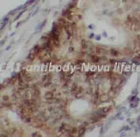 PTCH1 antibody - Click Image to Close