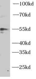 PTEN antibody - Click Image to Close