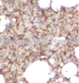 Periplakin antibody - Click Image to Close