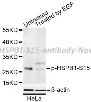 Phospho-HSPB1-S15 antibody - Click Image to Close