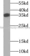 RANKL antibody - Click Image to Close