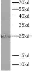 RBTN1 antibody - Click Image to Close