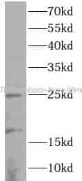 RBTN2 antibody - Click Image to Close