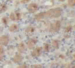 RECK antibody - Click Image to Close
