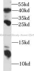 S100A8 antibody - Click Image to Close