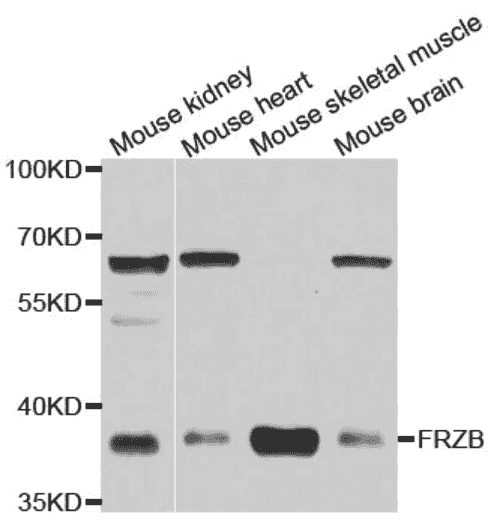 SFRP3 Antibody - Click Image to Close