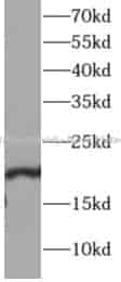 SKP1 antibody - Click Image to Close